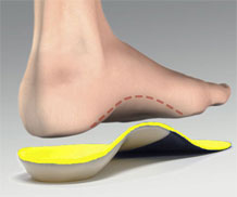 Dr Foot Custom Insoles (pair)